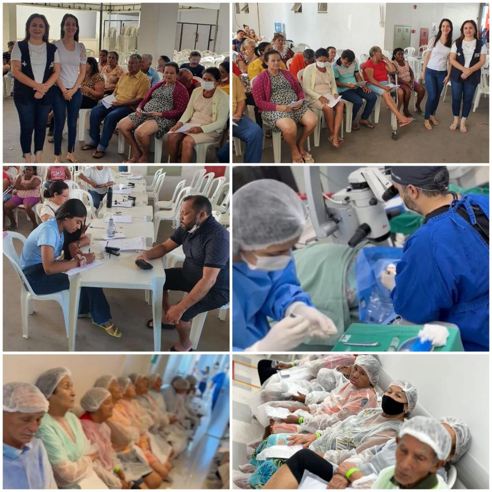 O Mutirão Oftálmico em Imperatriz foi uma resposta concreta as demandas da comunidade, proporcionando acesso rápido e efetivo aos cuidados oftalmológicos
